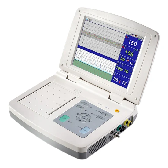 Monitor Fetal Monitor de Frequência Cardíaca Fetal para Grávidas Usado em Hospital