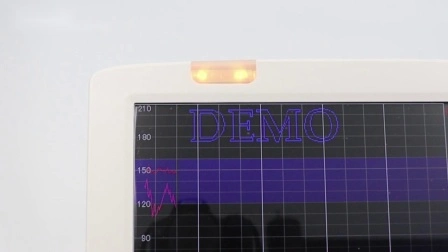 Monitor de frequência cardíaca fetal aprovado pela Ce&ISO da Meditech com função de reprodução